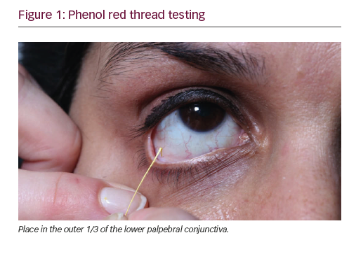 Diagnostic Tools for Dry Disease | touchOPHTHALMOLOGY