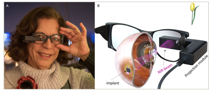 Figure 1: The PRIMA bionic vision system for providing central vision to subjects with geographic atrophy. (a) PRIMA glasses with the projection module including the camera; (b) artistic rendering of the augmented reality glasses capturing a video of a flower and projecting it onto the retina using near-infrared laser.